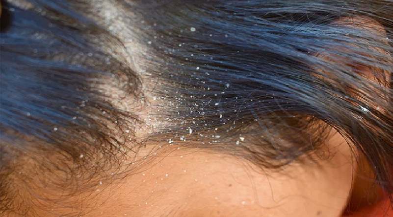 nnnnnnnnnnnnnnnnnnnnnnnnnnnn-1774612341